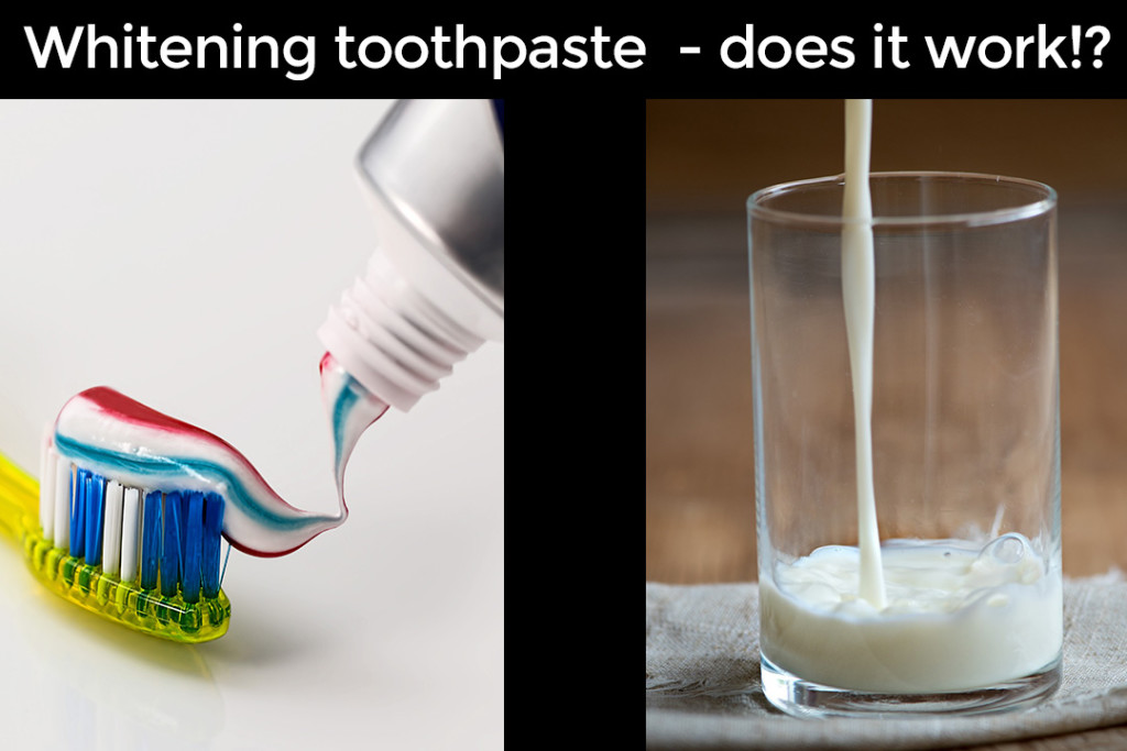 The Truth about tooth whitening